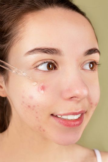 Tweens & Teens Facial - Image 2